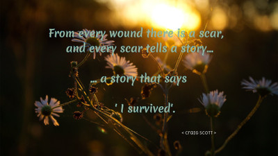 Akhuratha a-quote-quotes-story-scar-survivor Wall Poster Paper Print(12 inch X 18 inch, Rolled)
Akhuratha a-quote-quotes-story-scar-survivor Wall Poster Paper Print(12 inch X 18 inch, Rolled)