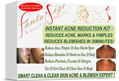 FANTASIZE INSTANT ACNE, SPOTS, BLEMISHES, PIMPLE REMOVAL. INSTANT CLARITY IN 30 MINUTES ACNE TREATMENT KIT(300 g)