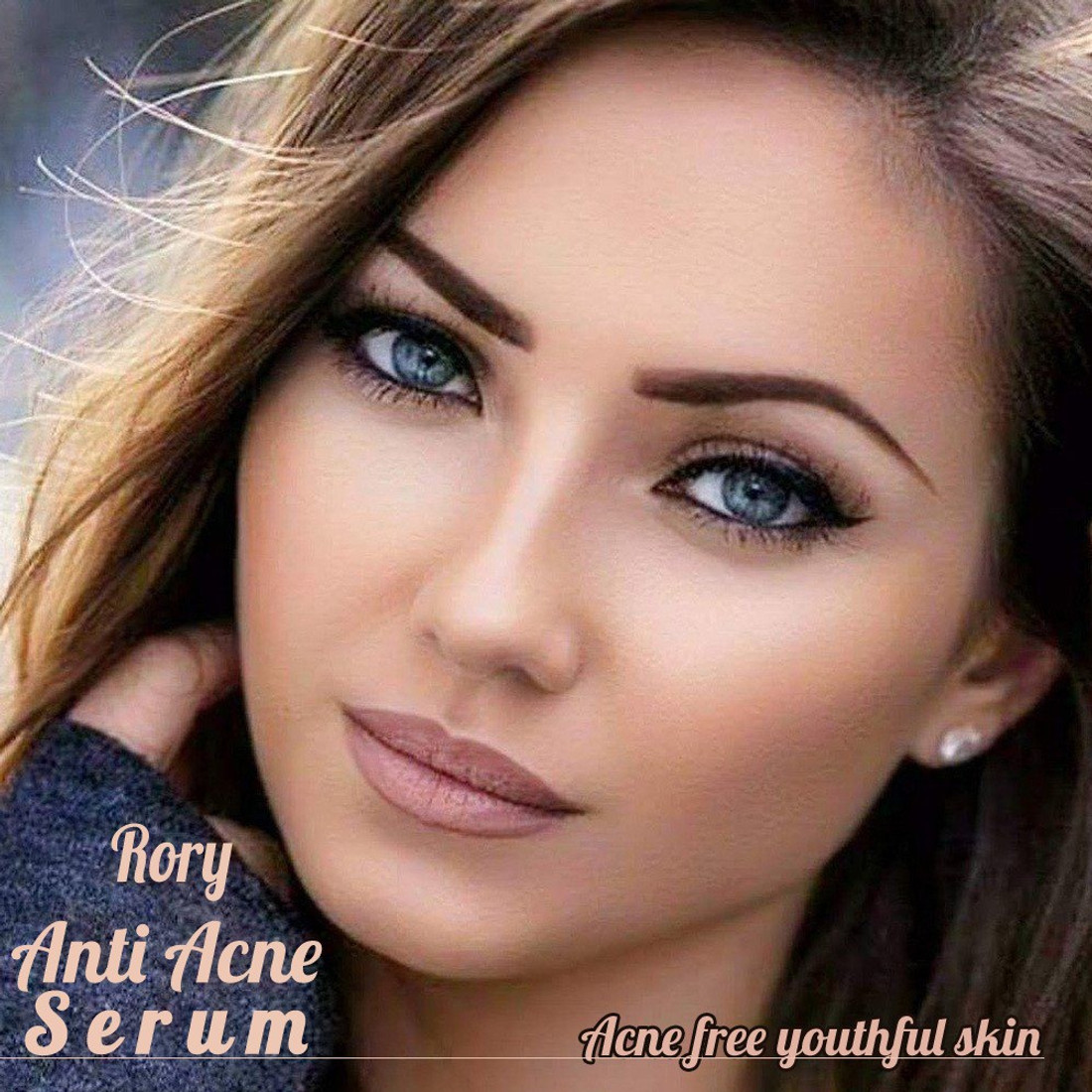 rory acne