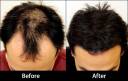 Osking Hair Building Fibers Refill Pack  (Hair Loss Concealer) For  All Fibres (Dark Brown)� - Price in India, Buy Osking Hair Building Fibers  Refill Pack  (Hair Loss Concealer) For All