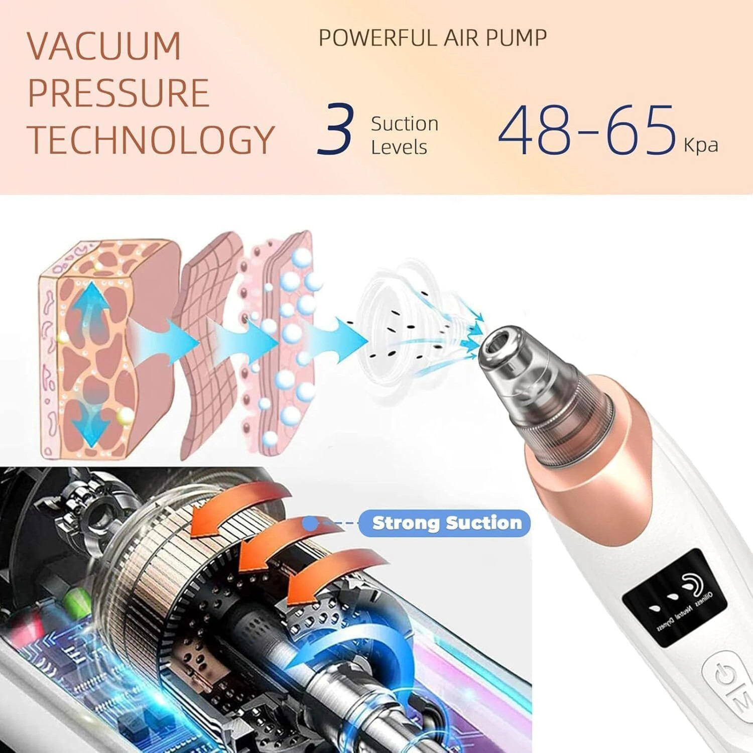 Image of Lumifrens Plastic Blackhead Remover Vacuum Suction Device (Pack of 5)