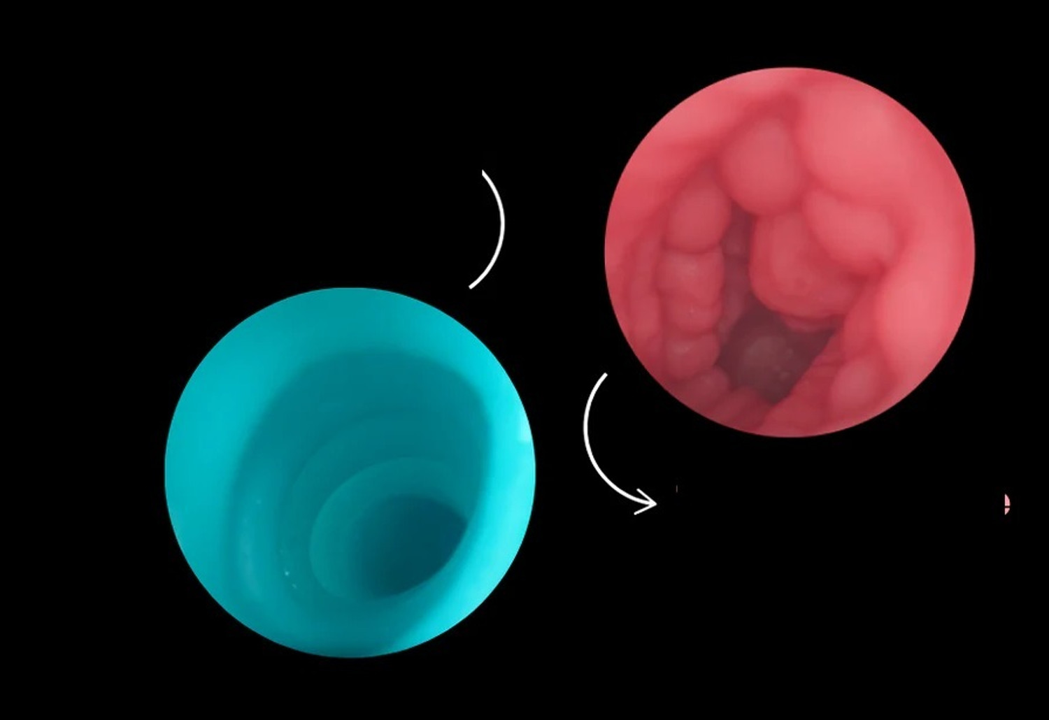 Image of PERLENTE unique Soft Flexible Personal Body Stress Relief Massager