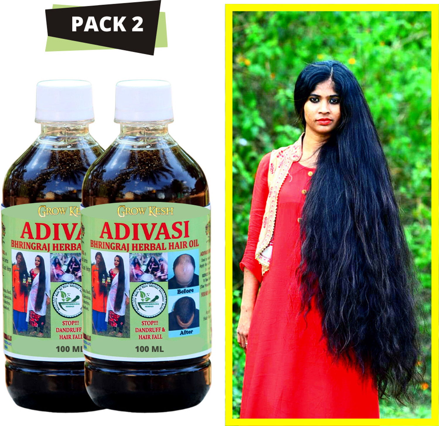 Image of Growkesh Onion AyurVedic- Hair Regrowth oil (pack of 2) Hair Oil
