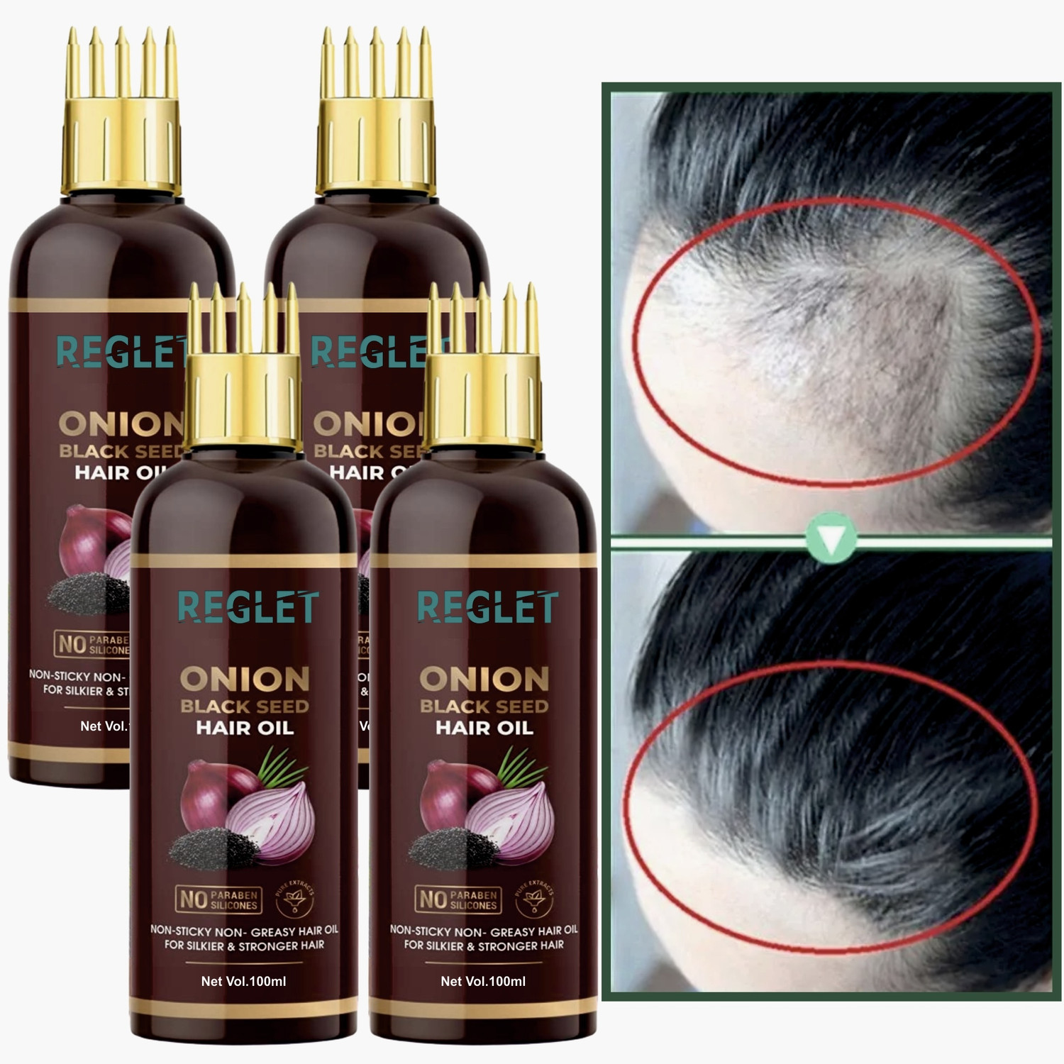 REGLET Onion Hair Oil - Black Seed Onion Hair Oil - WITH COMB ...