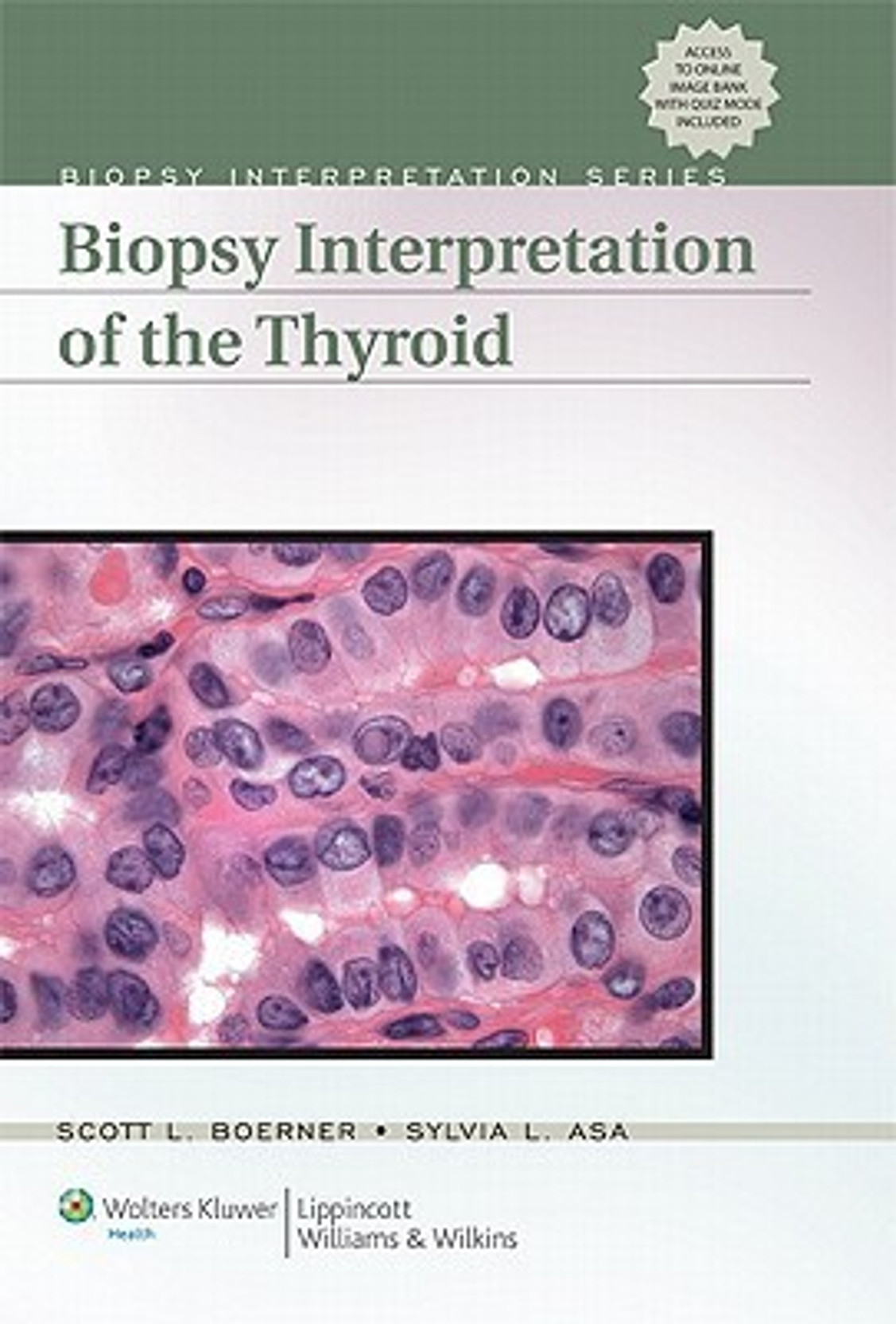 Biopsy Interpretation Series: Biopsy Interpretation Of The Thyroid 1 Har/Psc Edition. ADD TO CART