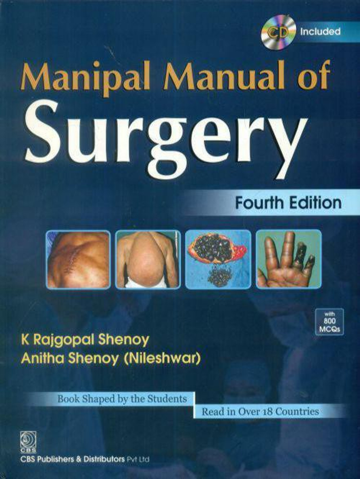 Manipal Manual of Surgery 4th Edition - Buy Manipal Manual of Surgery