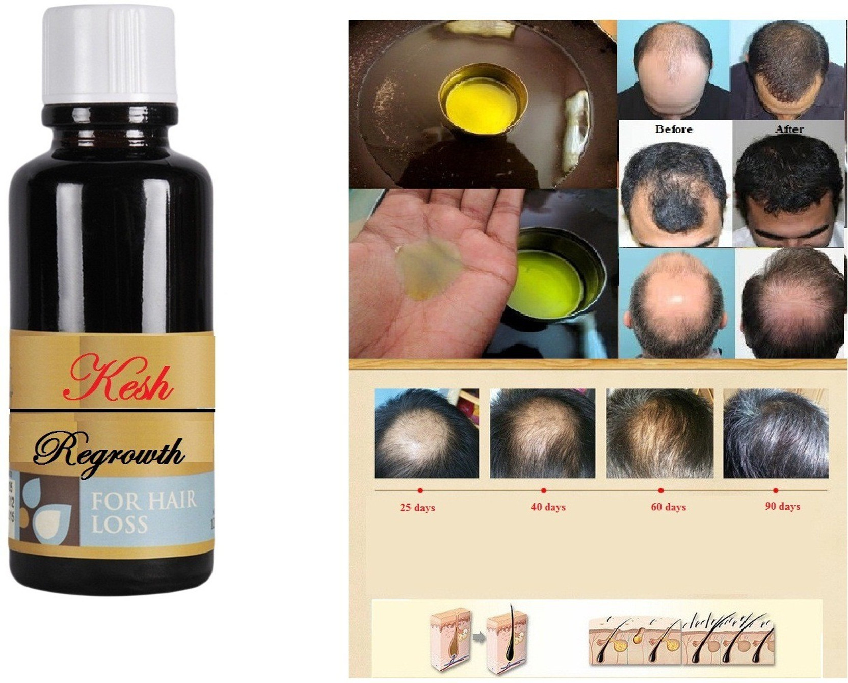 Kesh Regrowth ayurvedic Hair Oil Price in India, Buy Kesh Regrowth