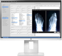 HP 24 inch Full HD IPS Panel Monitor (Z0A71A8#ABA)(Response Time: 8 ms)