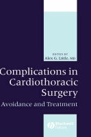 Complications in Cardiothoracic Surgery(English, Hardcover, unknown)