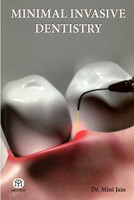 Minimal Invasive Dentistry (Pb)(English, Paperback, Mini Jain)