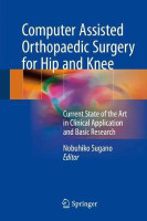 Computer Assisted Orthopaedic Surgery for Hip and Knee(English, Hardcover, unknown)