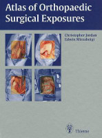 Atlas of Orthopaedic Surgical Exposures(English, Hardcover, Jordan Christopher)