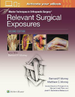 Master Techniques in Orthopaedic Surgery: Relevant Surgical Exposures(English, Hardcover, Morrey Bernard F. MD)