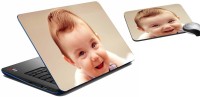 meSleep Smiling Baby Laptop Skin And Mouse Pad 318 Combo Set(Multicolor)   Laptop Accessories  (meSleep)