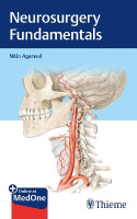 Neurosurgery Fundamentals(English, Mixed media product, Agarwal Nitin)
