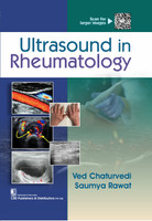 Ultrasound In Rheumatology(Hardcover, Ved Chaturvedi, Saumya Rawat)