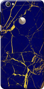 KanvasCases Back Cover for LeEco Le 1S