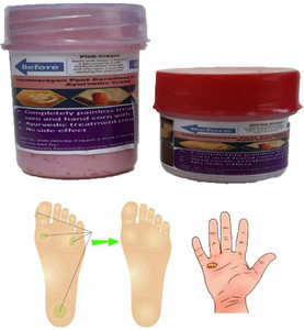 Foot corn treatment in ayurveda sales