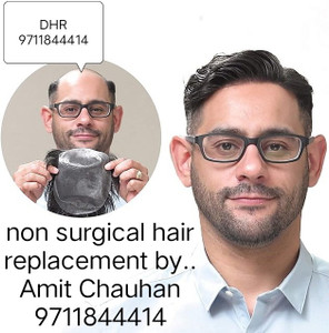 Hair Fixing in Delhi  Nile Hair N Skin Care Centre