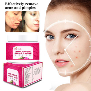 Face acne hot sale cream