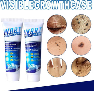 Strongest hotsell wart remover