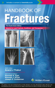 Handbook of Fractures: Amazon.co.uk: Kenneth A. Egol