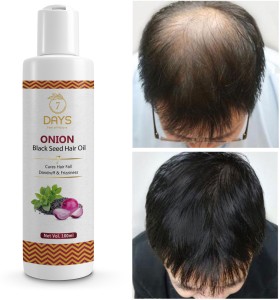 7 Days Germinal Hair Growth Serum Essence Oil Hair Loss Growth Hair for Men  Women