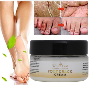 White Leaf Chapped Hand And Foot Cream Crack Peeling Repair Anti Dry Skin Price in India Buy White Leaf Chapped Hand And Foot Cream Crack Peeling Repair Anti Dry Skin Online