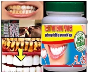 SILNOVO Moldable Teeth Veneers with Adhesive Fitting Beads Temporary False  Teeth Teeth Wipe Price in India - Buy SILNOVO Moldable Teeth Veneers with  Adhesive Fitting Beads Temporary False Teeth Teeth Wipe online