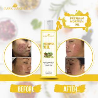 PARK DANIEL Premium Moringa oil(100 ml) Hair Oil - Price in India, Buy PARK DANIEL Premium Moringa oil(100 ml) Hair Oil Online In India, Reviews, Ratings & Features PARK DANIEL Premium Moringa oil(100 ml) Hair Oil - Price in India, Buy PARK DANIEL Premium Moringa oil(100 ml) Hair Oil Online In India, Reviews, Ratings & Features