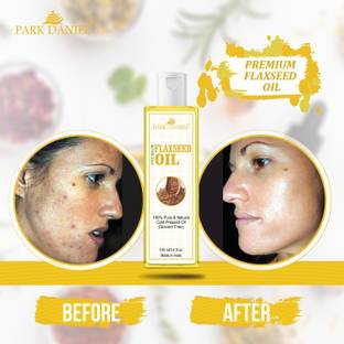 PARK DANIEL Premium Flaxseed oil(100 ml) Hair Oil - Price in India, Buy PARK DANIEL Premium Flaxseed oil(100 ml) Hair Oil Online In India, Reviews, Ratings & Features PARK DANIEL Premium Flaxseed oil(100 ml) Hair Oil - Price in India, Buy PARK DANIEL Premium Flaxseed oil(100 ml) Hair Oil Online In India, Reviews, Ratings & Features
