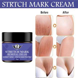 7 FOX Stretch Cream for Stretch Marks Removal Post Pregnancy fast work result
