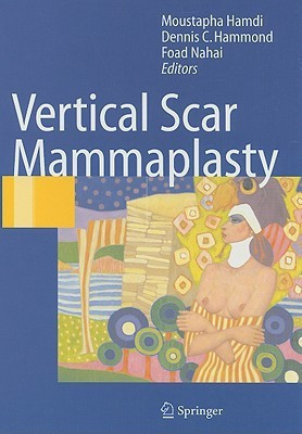 Vertical Scar Mammaplasty(English, Hardcover, unknown)