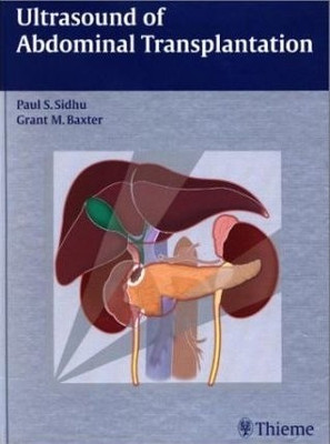 Ultrasound of Abdominal Transplantation / [Edited by] Paul S. Sidhu, Grant M. Baxter ; with Contributions by Syed Babar ... [Et Al.].(English, Hardcover, Sidhu Paul)