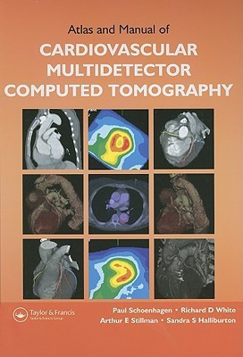 Atlas and Manual of Cardiovascular Multidetector Computed Tomography(English, Hardcover, Schoenhagen Paul)