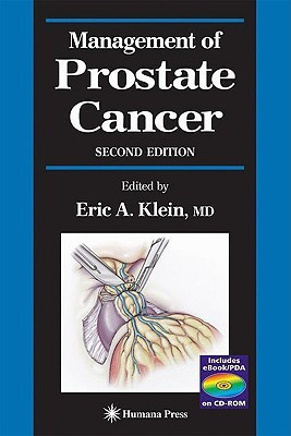 Management of Prostate Cancer(English, Hardcover, unknown)