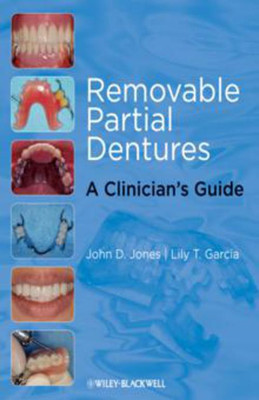 Removable Partial Dentures(English, Paperback, Jones John D.)