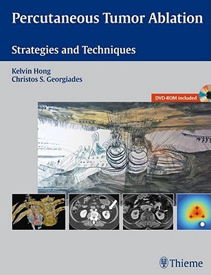 Percutaneous Tumor Ablation(English, Hardcover, unknown)