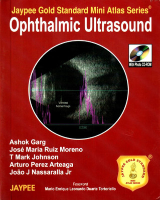 JAYPEE GOLD STANDARD MINI ATLAS SERIES OPHTHALMIC ULTRASOUND 1st Edition(English, Paperback, GARG)