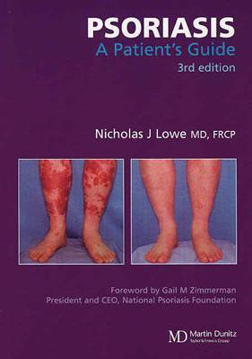 Psoriasis  - A Patient's Guide(English, Paperback, Lowe Nicholas J.)