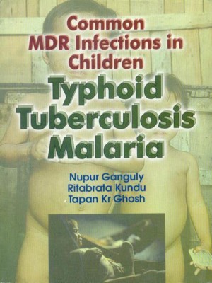 Common MDR Infections in Children Typhoid Tuberculosis Maleria(English, Paperback, unknown)