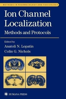 Ion Channel Localization(English, Paperback, unknown)