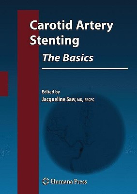 Carotid Artery Stenting: The Basics(English, Hardcover, unknown)