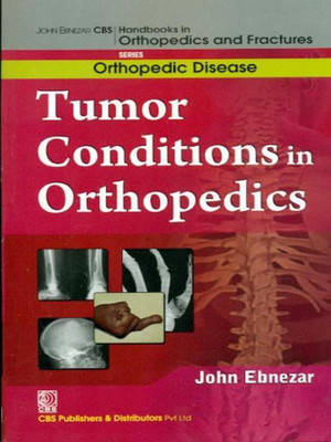 John Ebnezar CBS Handbooks in Orthopedics and Factures(English, Paperback, Ebnezar John)