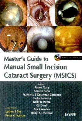 MASTER'S GUIDE TO MANUAL SMALL INCISION CATARACT SURGERY (MSICS) WITH INT.DVD-ROM 1st  Edition(English, Paperback, GARG)