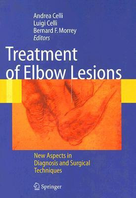 Treatment of Elbow Lesions(English, Hardcover, unknown)