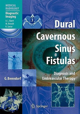Dural Cavernous Sinus Fistulas(English, Hardcover, Benndorf Goetz)