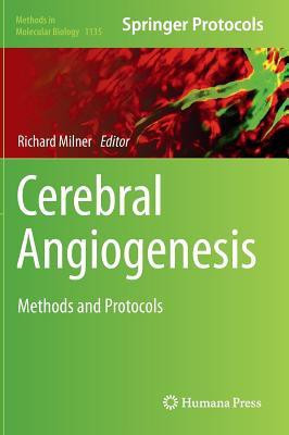 Cerebral Angiogenesis(English, Hardcover, unknown)