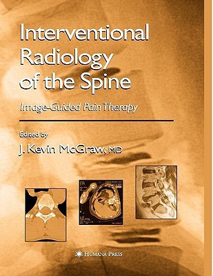 Interventional Radiology of the Spine(English, Paperback, unknown)