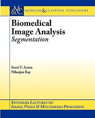 Biomedical Image Analysis(English, Paperback, Acton Scott)